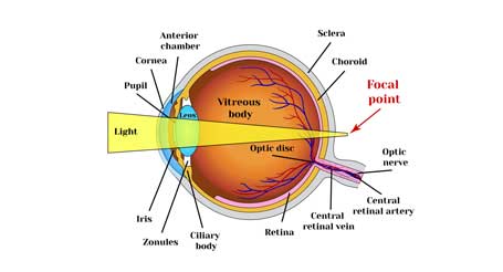 What is Presbyopia
